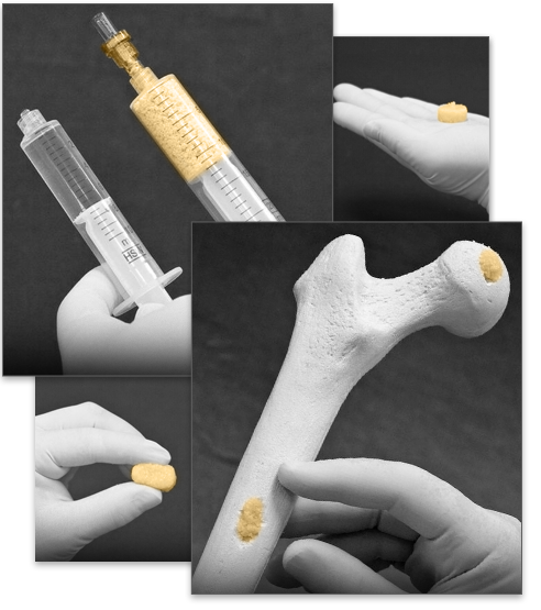 Graphic of nanofuse used on bone